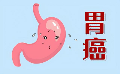 广州中医肿瘤医院案例|22岁男团偶像患胃癌,中医辨证施治挽回生命