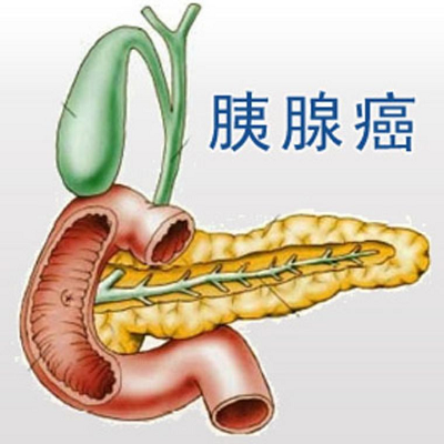 广州肿瘤专科医院|中医治疗胰腺癌疼痛的优势,你需要知道