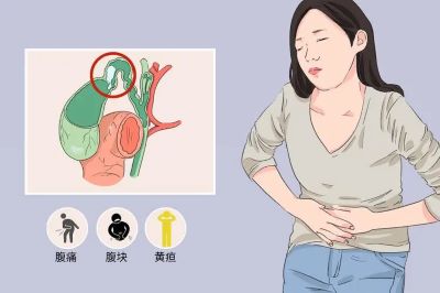 广州肿瘤中医院专家:这些胆囊癌危险因素你一定要了解,一起来看看